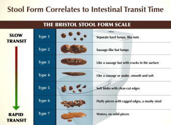 bristolstoolchart-graphic-constipated-but-soft-stool-1-884-x-663